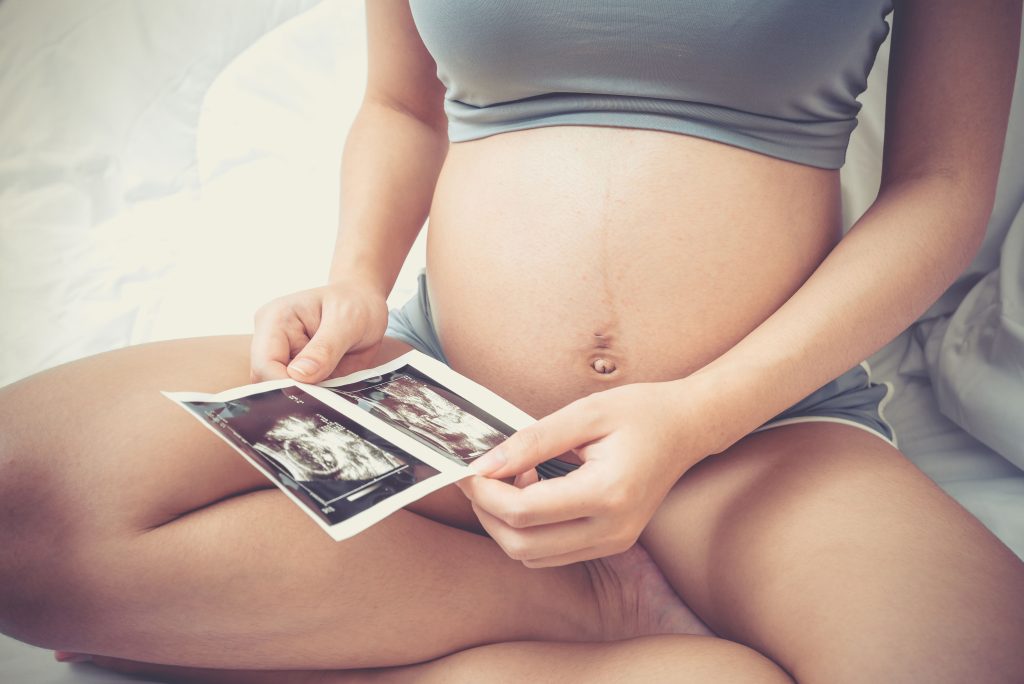 Cropped image of pregnant woman holding ultrasound